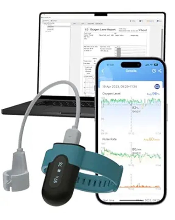 Vibeat OxyU Wrist Oxygen & Heart Rate Monitor